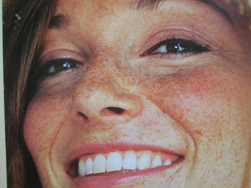 sonrisa_pecas