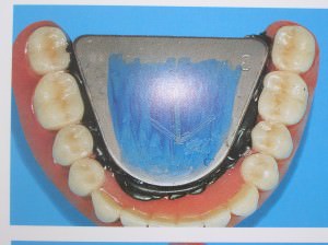 curso-implantes-011