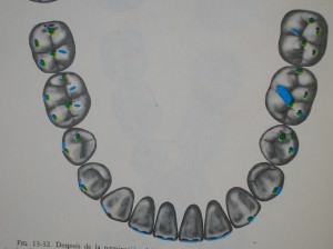 Disfruta de un descanso nocturno completo: ¡usa este protector bucal  nocturno para un sueño profundo de alta calidad! Bruxismo: ayuda a evitar  que se muela y se apriete los dientes. ¡Dormir bien-obtener