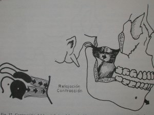 Ferula de descarga – Centro Odontológico – Hector Lafuente