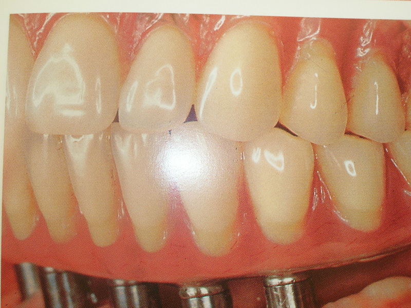 curso-implantes-030