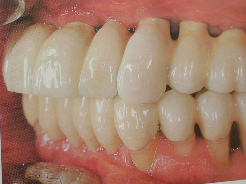curso-implantes-032