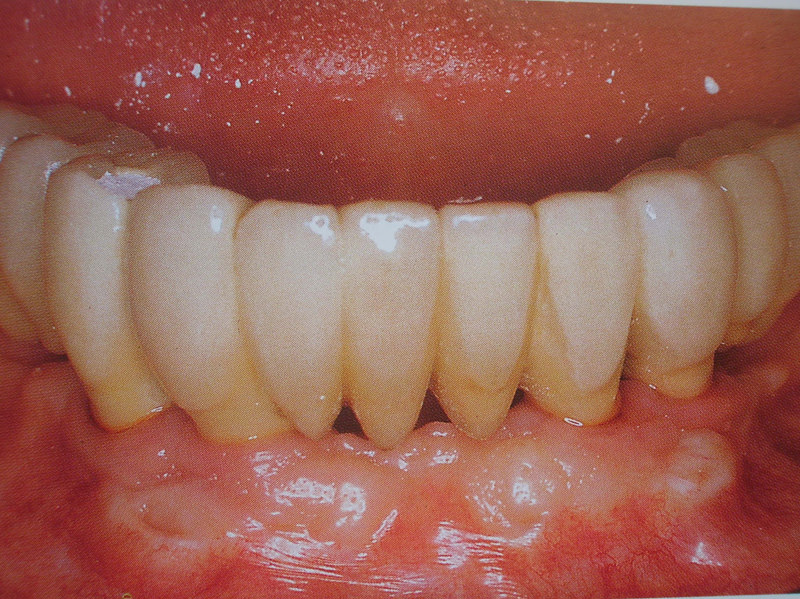 curso-implantes-069