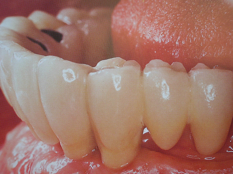 curso-implantes-070