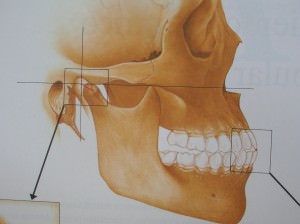 Dolor en la mandíbula, articulación temporomandibular (ATM) 