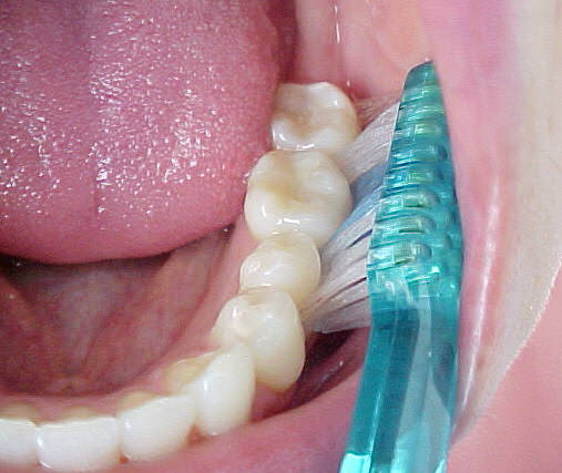 cepillado6
