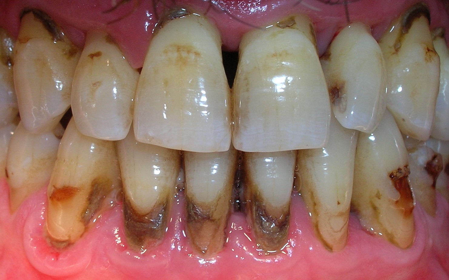 Cómo limpiar los cepillos de dientes eléctricos? - Torres Carranza