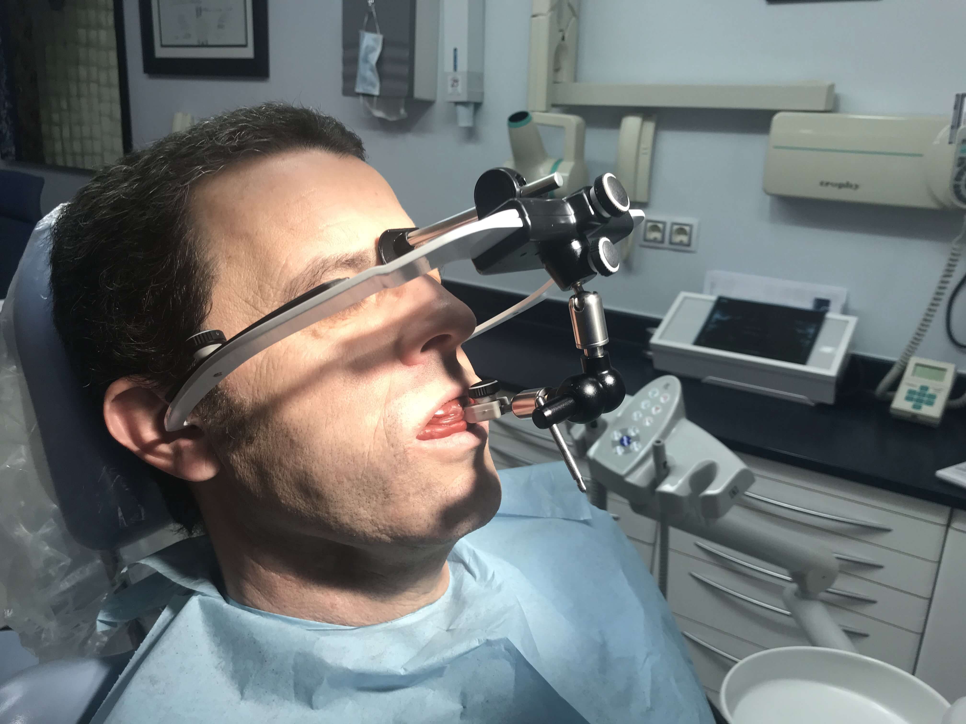 Arco facial puesto en posición